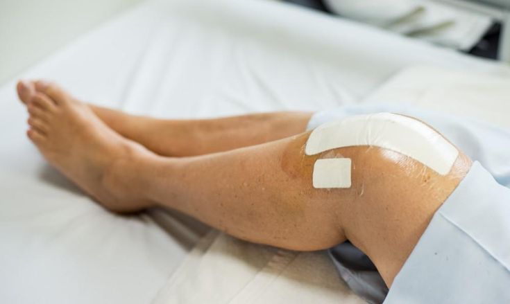 مراقبت از زخم بعد از جراحی