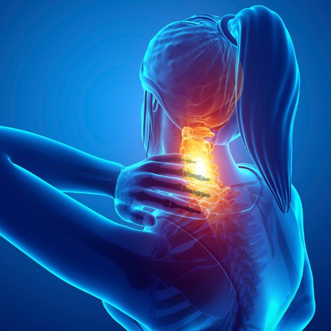 دلیل-ایجاد-فتق-دیسک-گردن