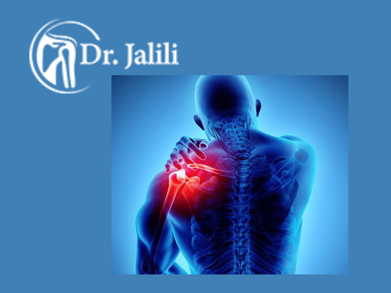 پیشگیری از بورسیت شانه 