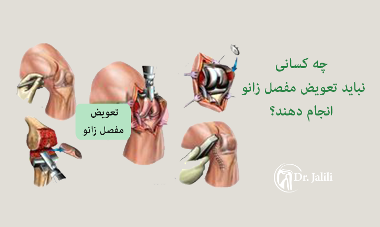 چه کسانی نباید تعویض مفصل زانو انجام دهند؟