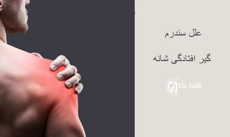 علل سندرم گیر افتادگی شانه